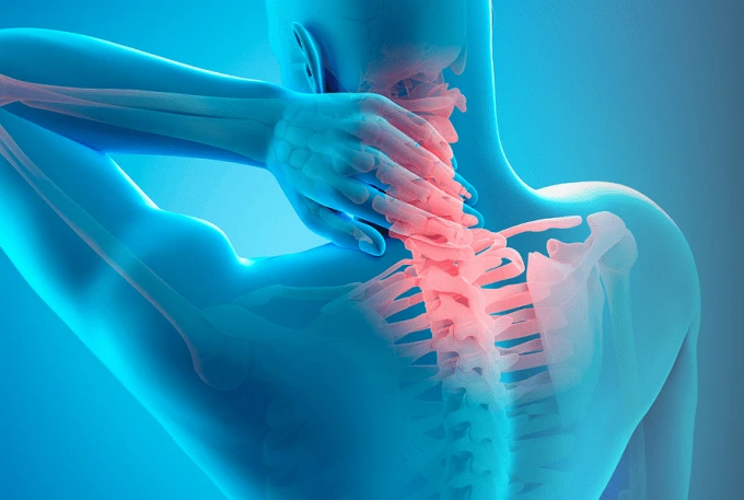 پیشگیری از بیرون‌زدگی دیسک