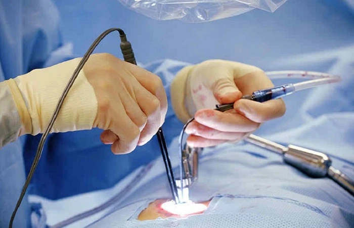 آندوسکوپی دیسک