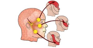 علت درد عصب سه قلو
