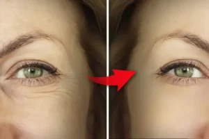 عوامل مؤثر بر دوام نتایج پی آر پی زیر چشم