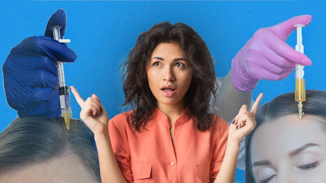 مقایسه پی آر پی مو و مزوتراپی