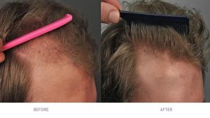 کاربردهای هر روش