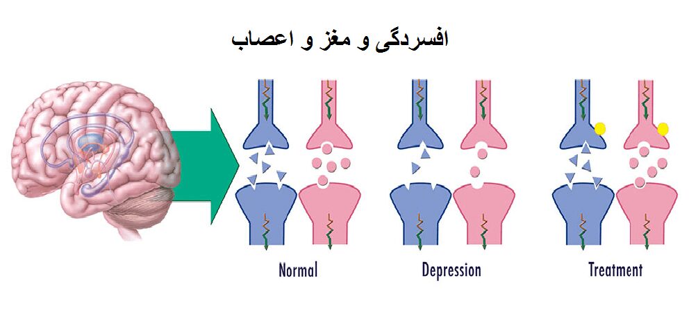 افسردگی و دردهای عصبی