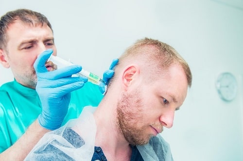 درمان سردردهای شدید با بلوک عصبی