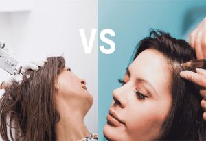 مقایسه پی آر پی مو و مزوتراپی