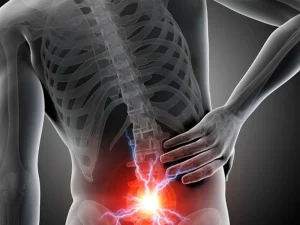 علل رایج دردهای عصب عضلانی