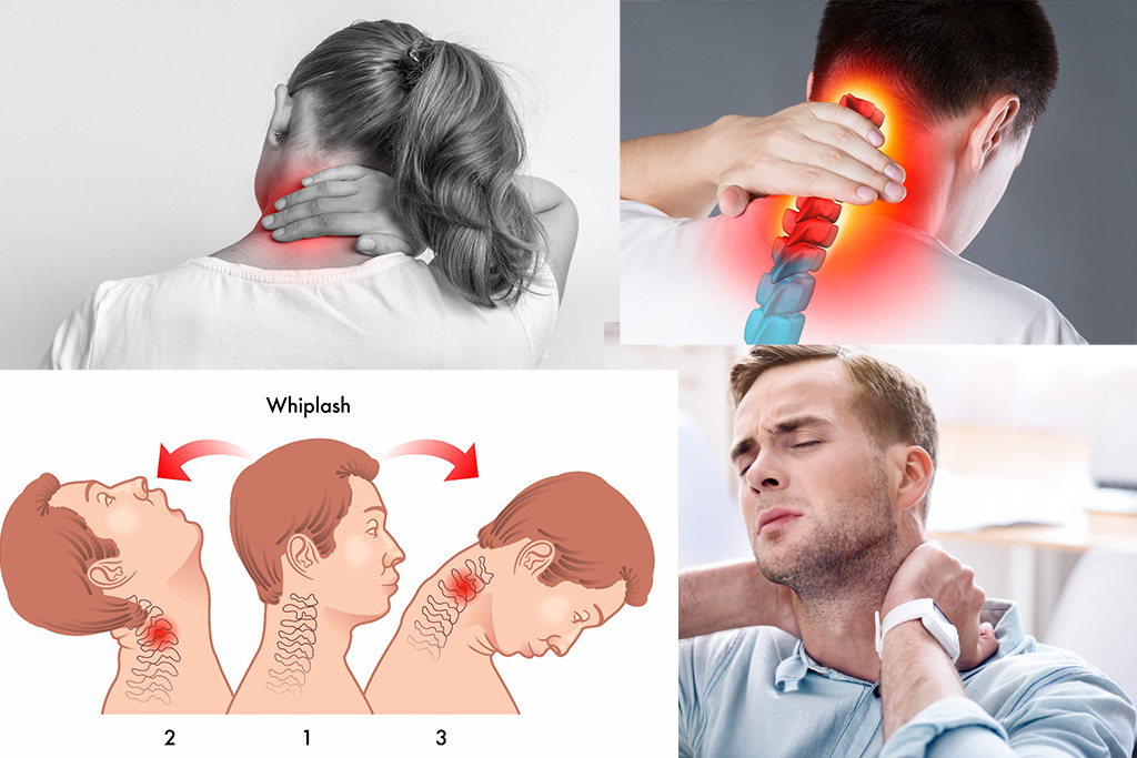 گردن درد عصبی را چگونه درمان کنیم؟